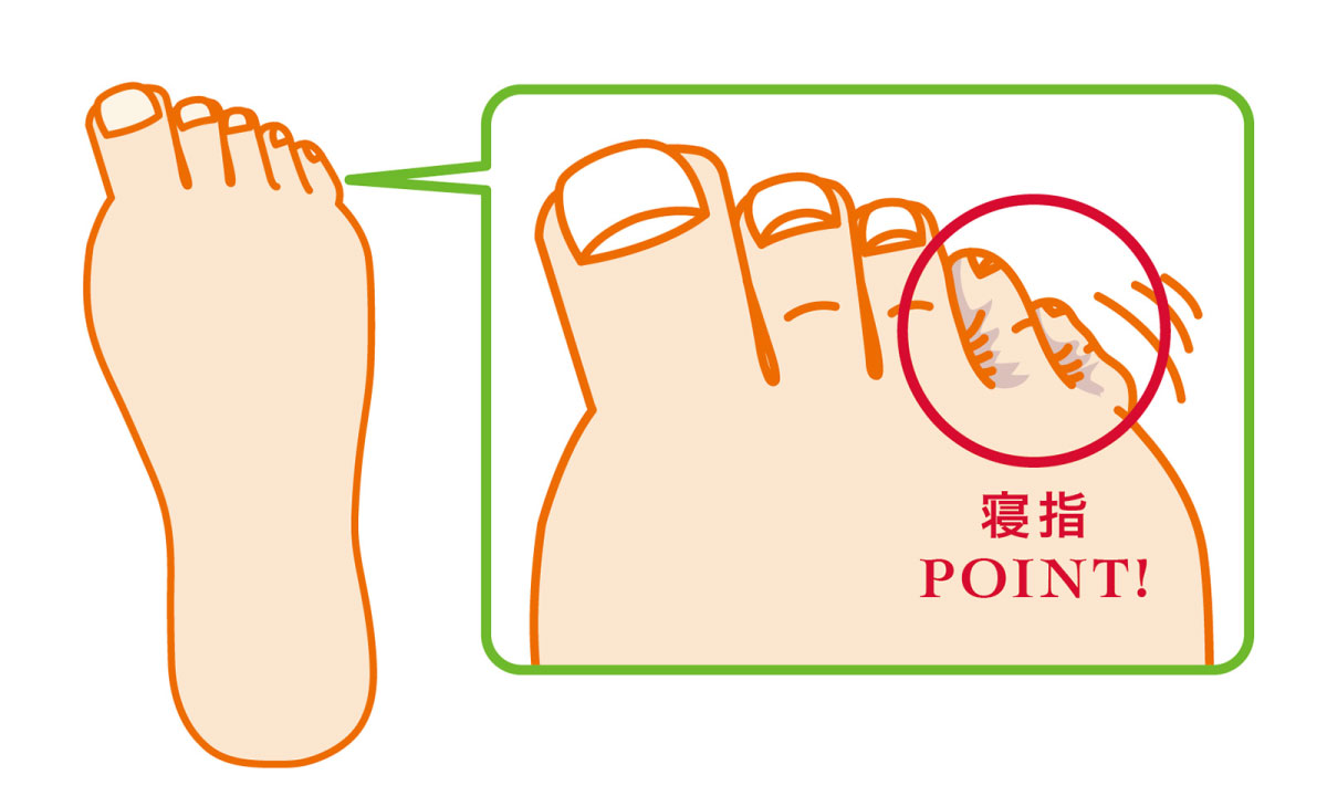 足の不調のカギは、小指にあった!? 寝指が目覚める、ほぐしストレッチ